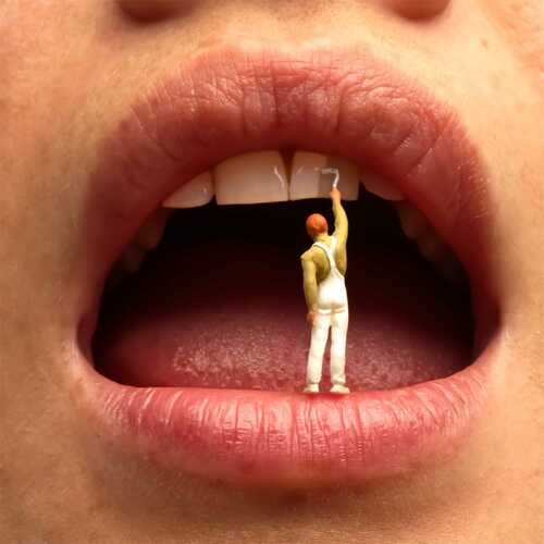 Blanchiement
